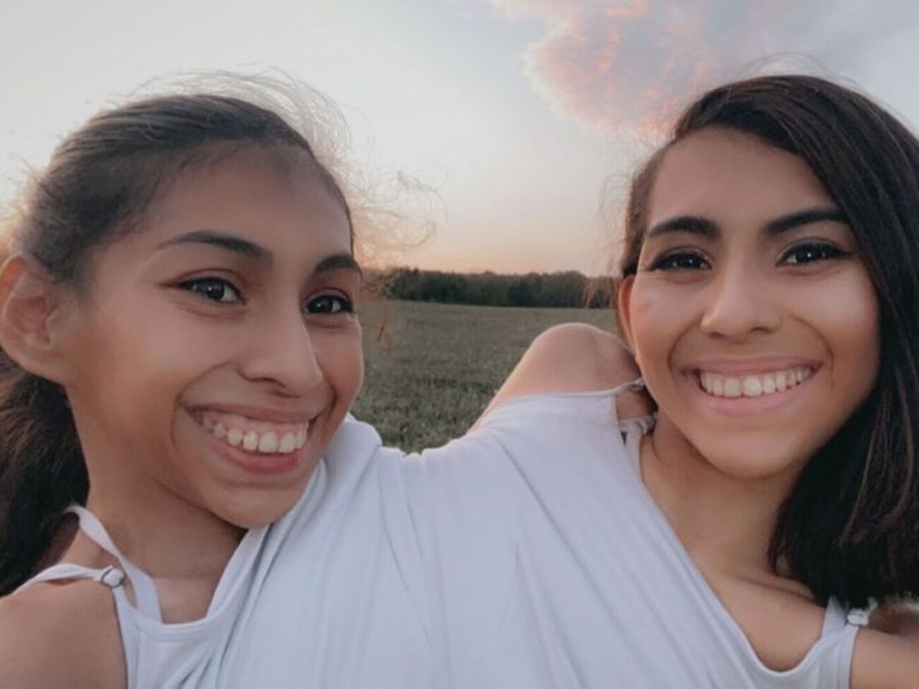 У сестер Андраде спільні ребра, кровоносна, травна й репродуктивна системи, але в кожної свої серце, легені й шлунок