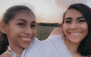 У сестер Андраде спільні ребра, кровоносна, травна й репродуктивна системи, але в кожної свої серце, легені й шлунок