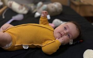 По словам руководителя клиники, операция была "совсем не типичная, мягко говоря"