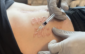 СМИ выяснили, кто из хирургов мог выжечь надпись на теле