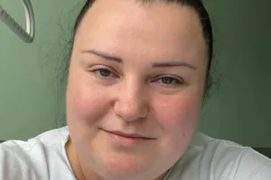 alyona alyona уменьшила желудок ради похудения. Какой был максимальный вес певицы