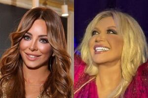 Злотник про Ані Лорак і Повалій: Для них гроші вирішують усе