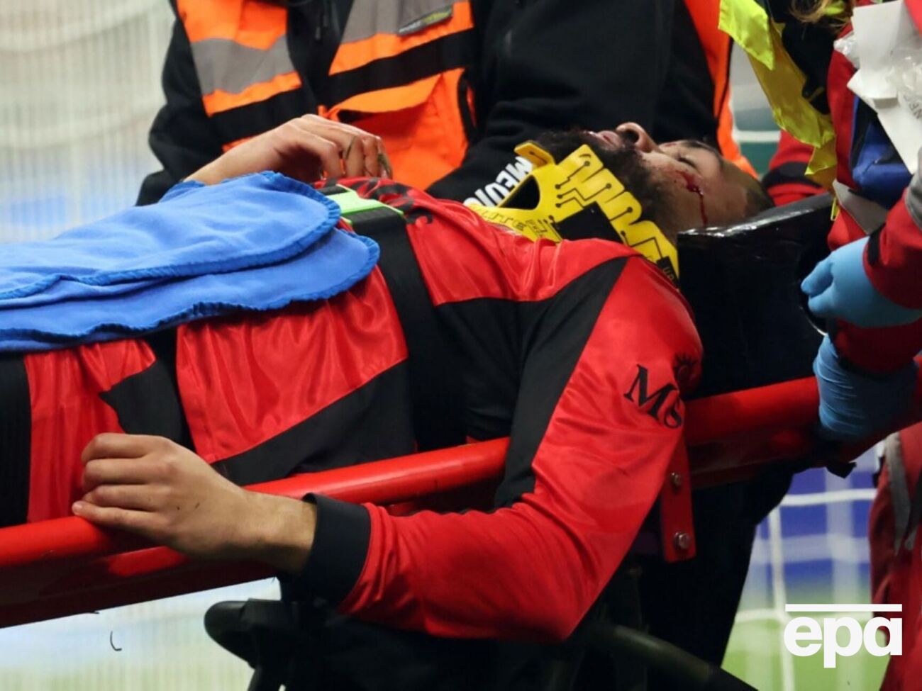 Лофтус-Чік: Це був важкий удар, але найгірше вже позаду