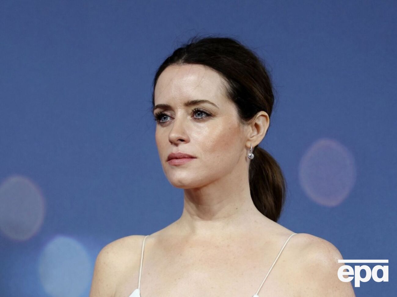 Фой: Кілька років тому в мене були глисти