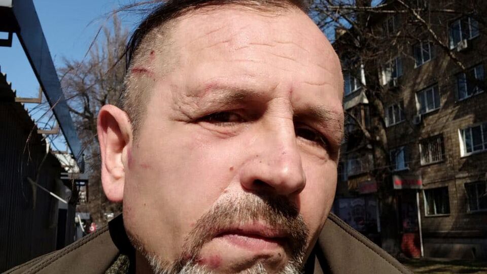 Военные признали, что доставили Балуха в ТЦК, однако отрицали избиение мужчины