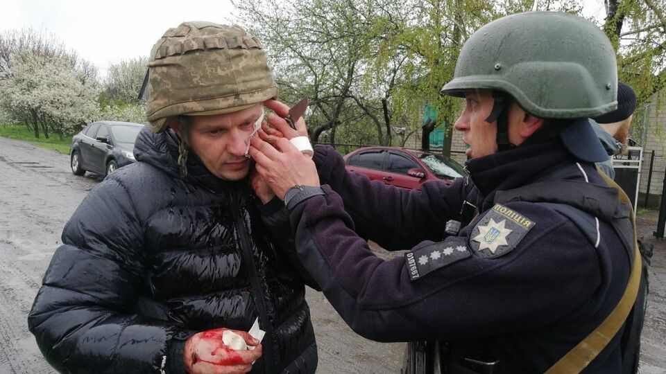 Через вибух гранати поліцейські дістали поранення