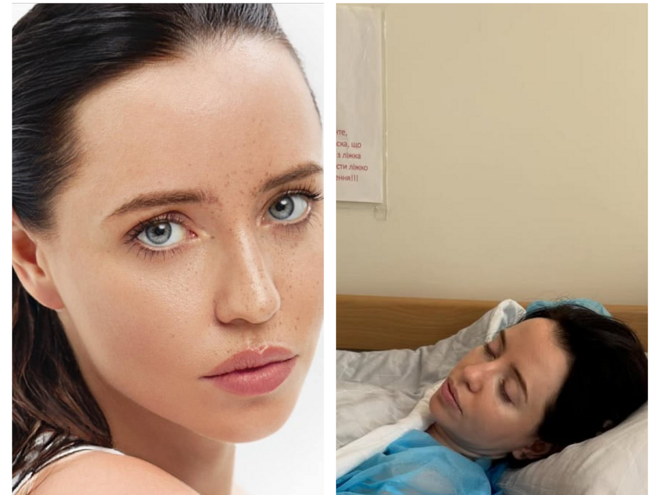 Дорофеева: Я приходил на съемки – все лицо усыпано прыщами, ну это жесть