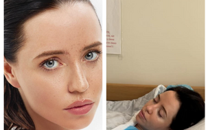 Дорофеева: Я приходил на съемки – все лицо усыпано прыщами, ну это жесть