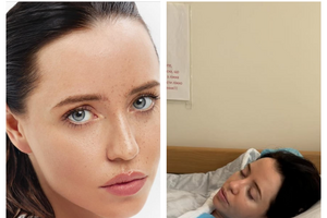 Дорофєєва: Я приходила на зйомки – усе обличчя всіяне прищами, ну це жесть