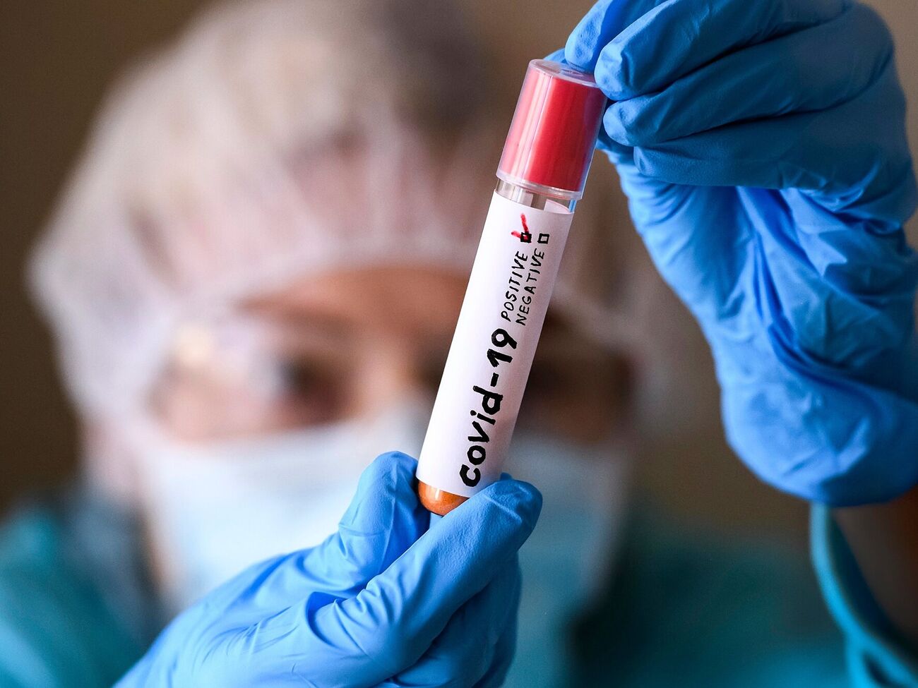 Новый субвариант COVID-19 "Цикада" получил название из-за неактивного характера распространения