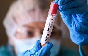 Новый субвариант COVID-19 "Цикада" получил название из-за неактивного характера распространения