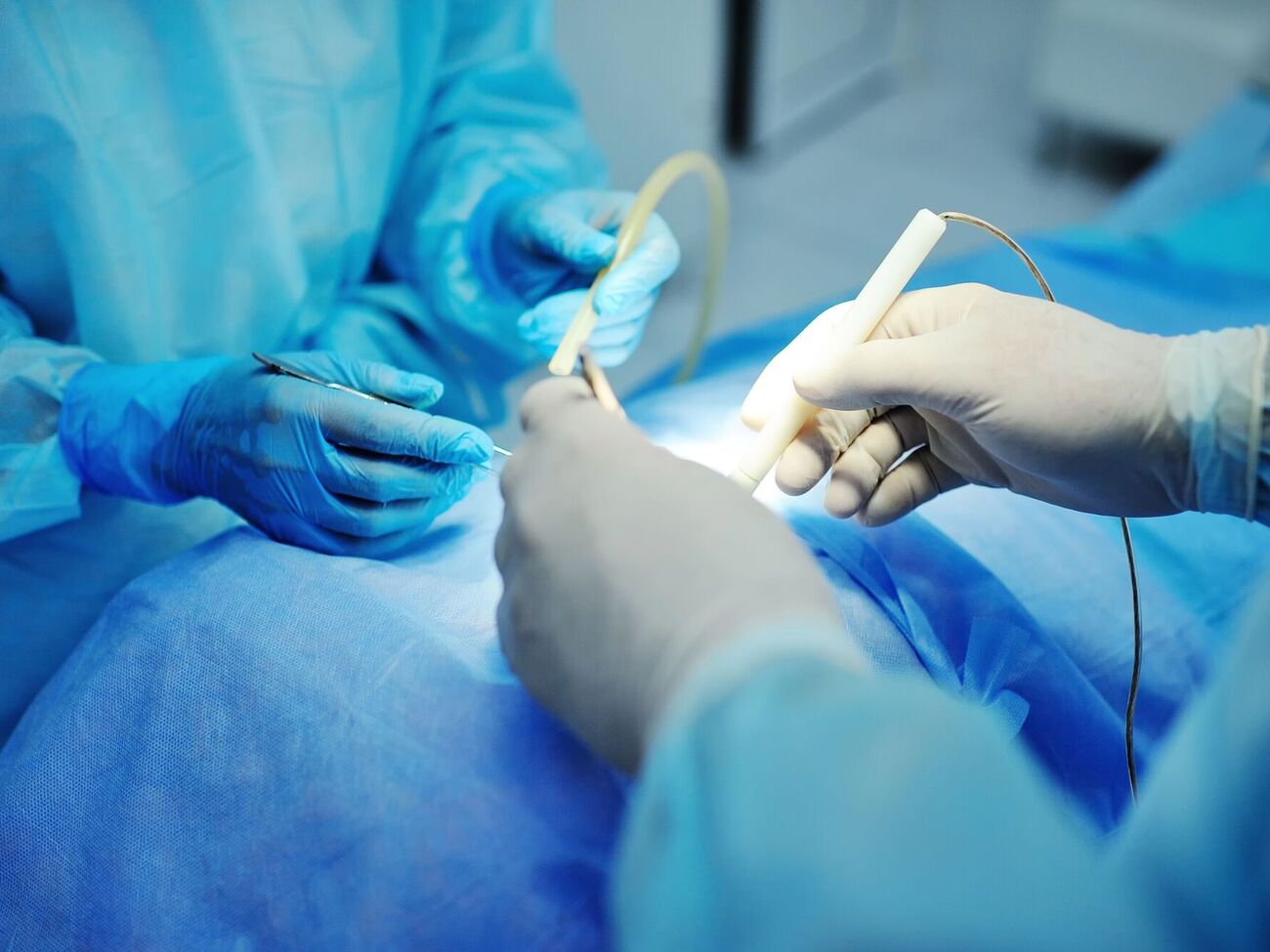 159 трансплантацій виконали в Україні від початку року – підсумки першого кварталу 2026 року