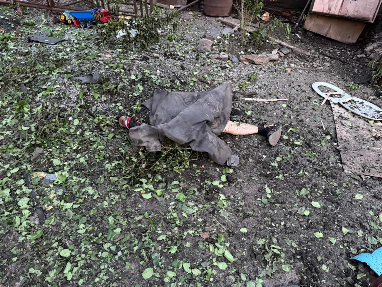 Лікарі врятували ніжку немовляті з Кривого Рогу, яке постраждало через російську атаку