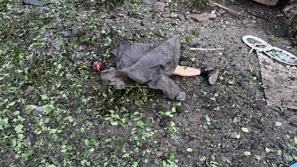 Лікарі врятували ніжку немовляті з Кривого Рогу, яке постраждало через російську атаку