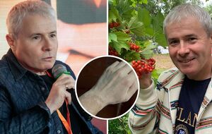 Известный ведущий рассказал о своей неизлечимой болезни: Это не мешает жить, любить, мечтать
