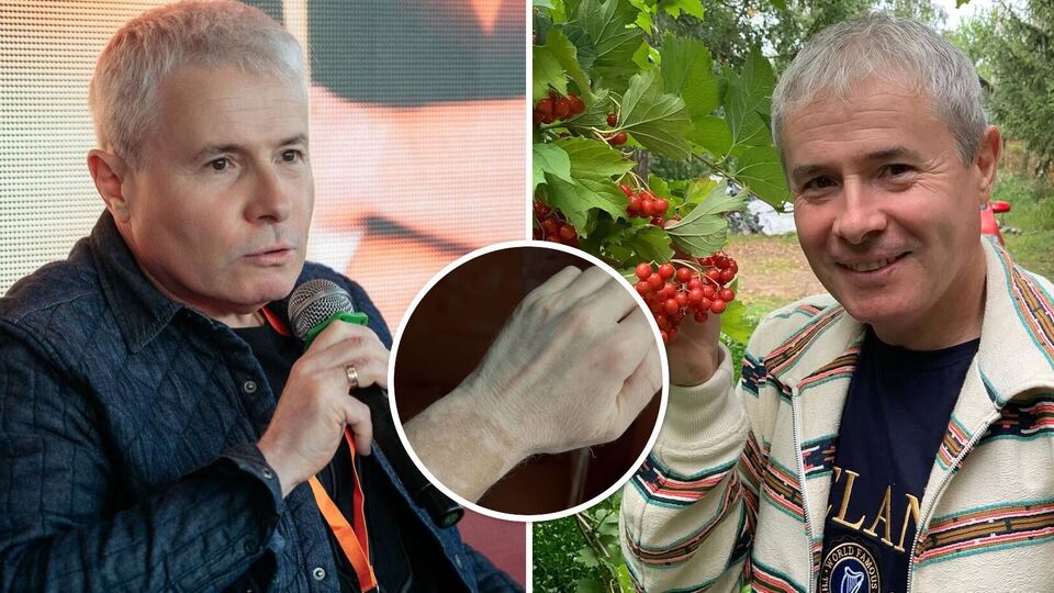 Відомий ведучий розповів про свою невиліковну хворобу: Це не заважає жити, любити, мріяти